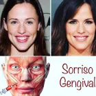 Imagem 5 da empresa DRA MARIANA PEREIRA Botox em Barretos SP