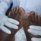 Imagem 2 da empresa GABRIELA DE SOUSA - PODÓLOGA Podólogos em Rio De Janeiro RJ