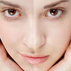 Imagem 3 da empresa SILUETS - FOTODEPILAÇÃO E ESTÉTICA Clínicas De Estética em Brasília DF