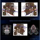 Imagem 4 da empresa XSLICE TOMOGRAFIA RADIOLOGIA E DIAGNÓSTICO ODONTOLÓGICO Tomografia E Ressonância Magnetica em Taubaté SP