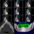 Imagem 1 da empresa XSLICE TOMOGRAFIA RADIOLOGIA E DIAGNÓSTICO ODONTOLÓGICO Tomografia E Ressonância Magnetica em Taubaté SP