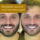 Imagem 2 da empresa ZANELATO ESTÉTICA DENTAL | TRATAMENTOS ODONTOLÓGICOS E ODONTOLOGIA DIGITAL Dentistas em Vitória ES