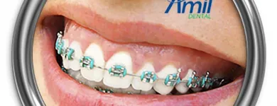 Imagem 2 da empresa AMIL DENTAL CLÍNICA NATAL Dentistas em Natal RN