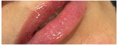 Imagem 2 da empresa AS ALMEIDAS PODOLOGIA/ESTÉTICA FACIAL Clínicas de Podologia em Rio De Janeiro RJ